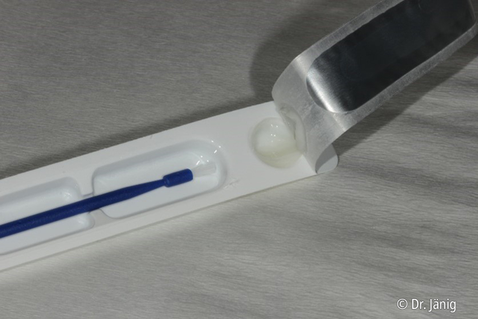 Enamelast™ fluoride varnish Combining an excellent fluoride release