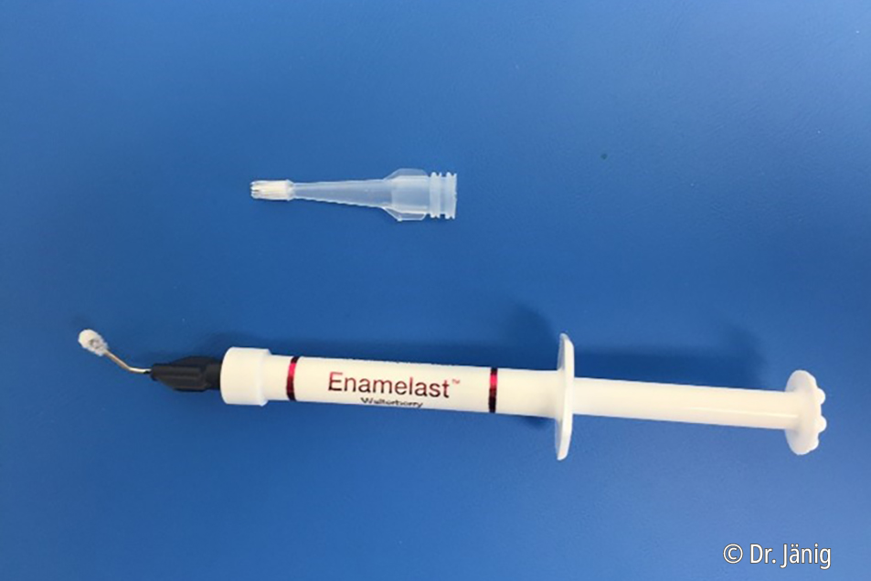 Enamelast™ fluoride varnish Combining an excellent fluoride release with a great taste