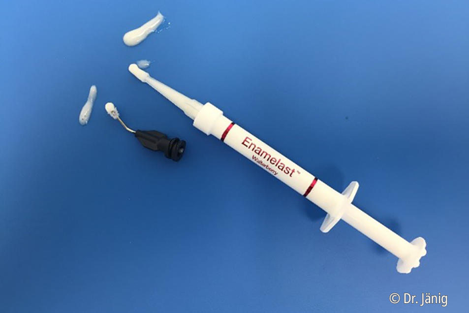 Enamelast™ fluoride varnish Combining an excellent fluoride release