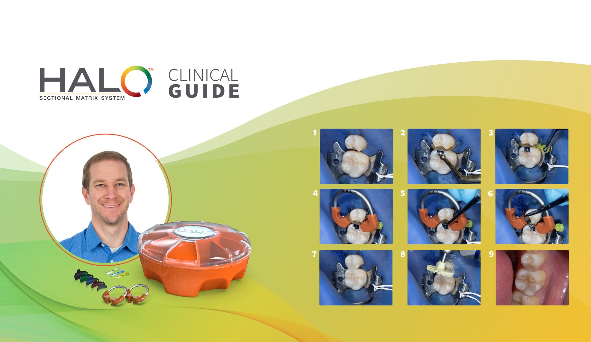 Clinical Guide: Class II Restoration on a Mandibular Second Premolar