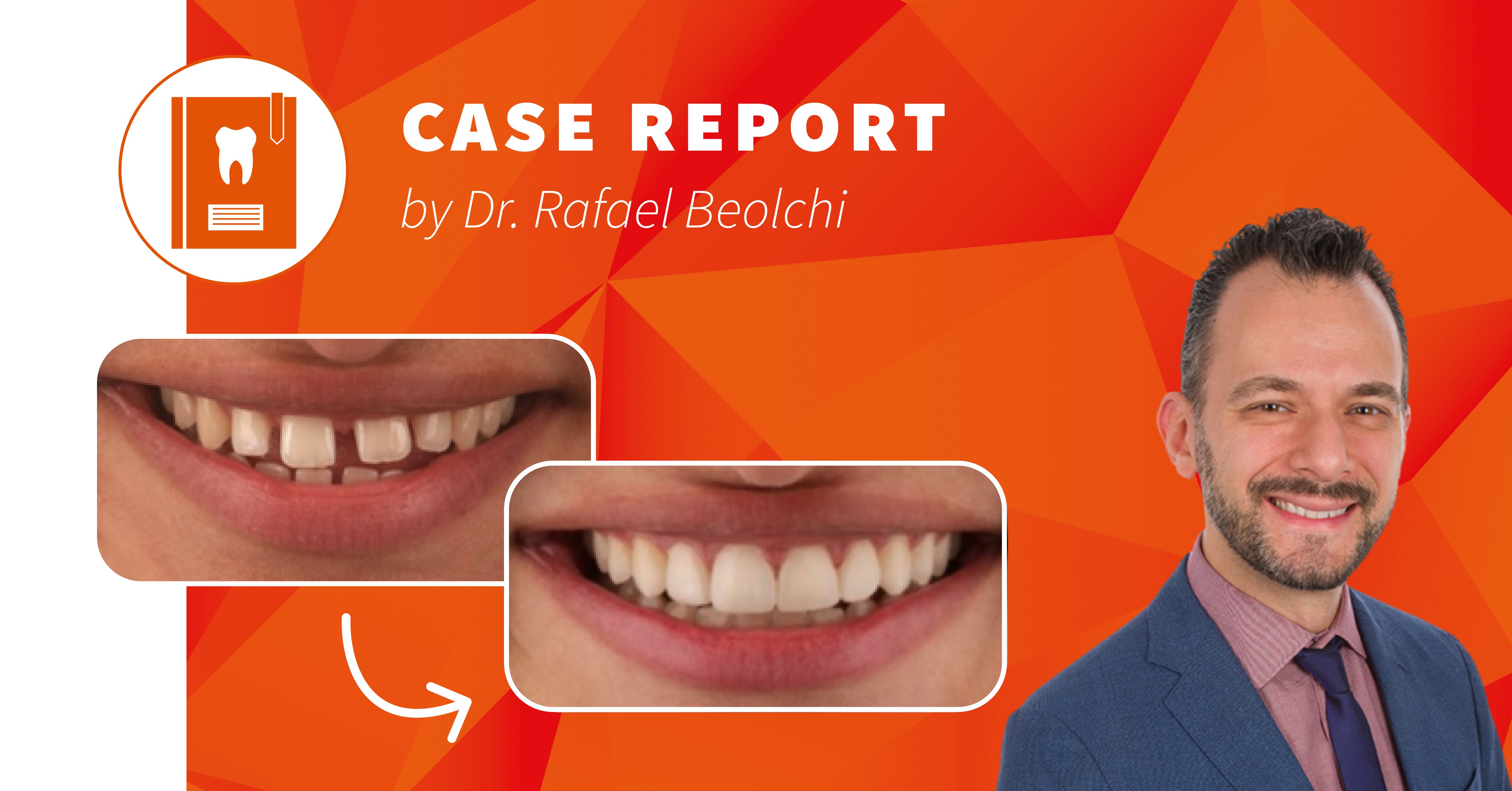 How Diode Lasers and Universal Composites Simplify Daily Practice Life