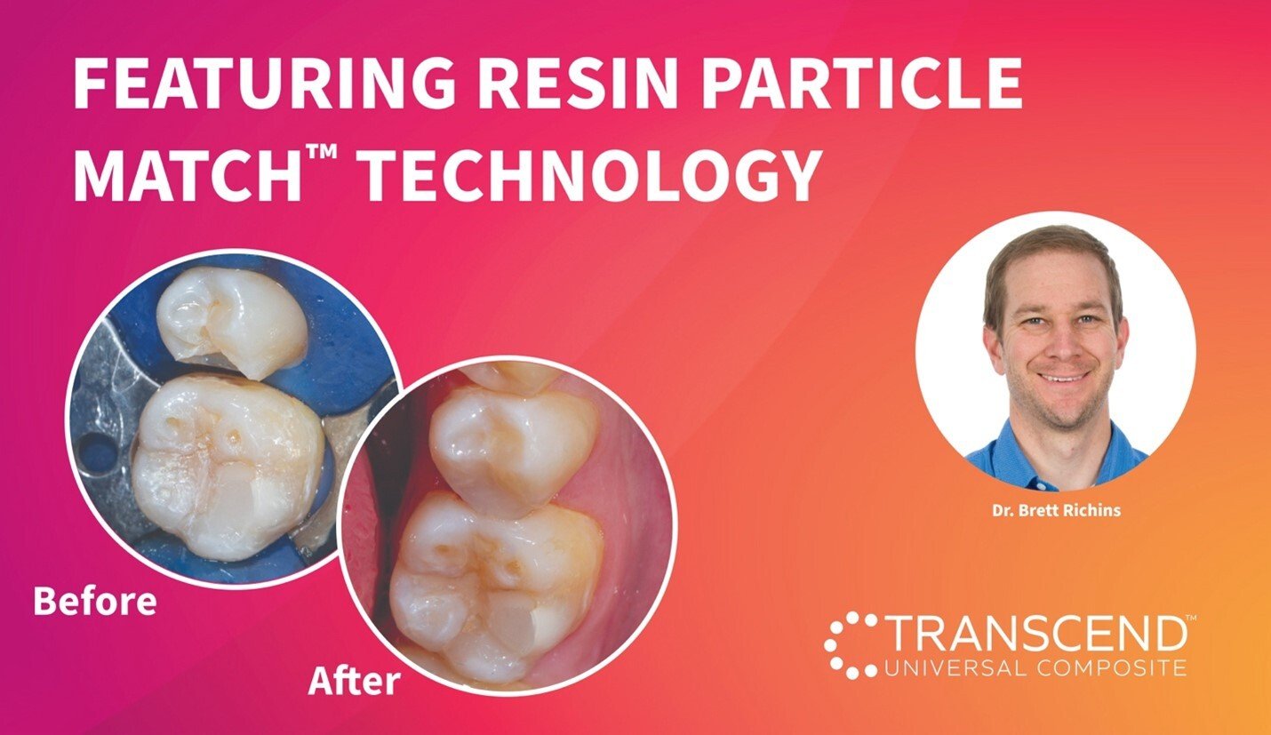 Clinical Guide: Class II Restoration of Tooth #45